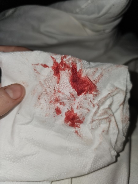 Worried if I'm having a miscarriage or not?