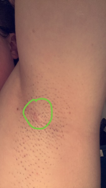 how do I start a thread