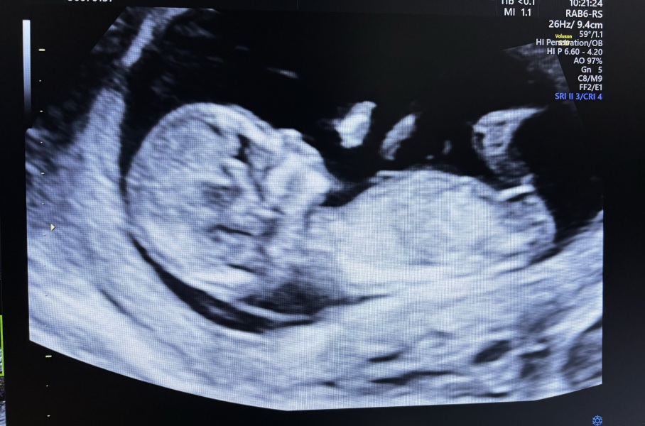 Any nub theorists can guess my baby?