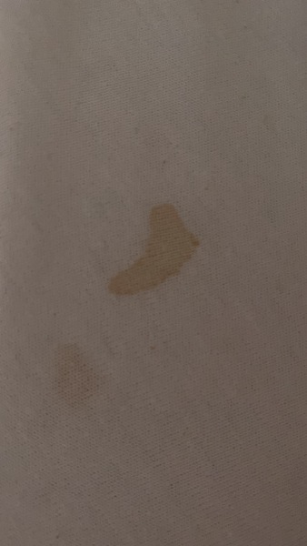 33 weeks and bloody nipple discharge?!