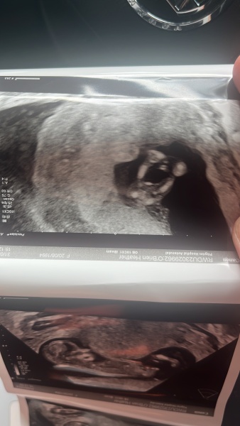 Can you guess my baby’s gender?