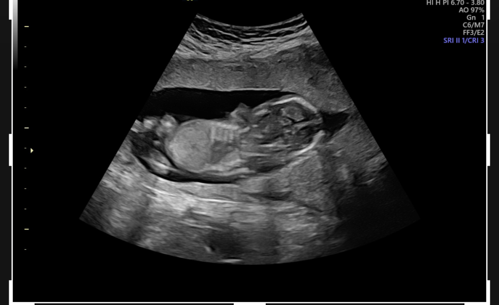 Is this a penis? Gender guess