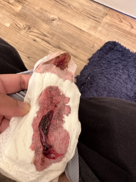 Possible miscarriage? 6 weeks 4 days