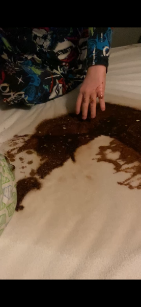 Black vomit