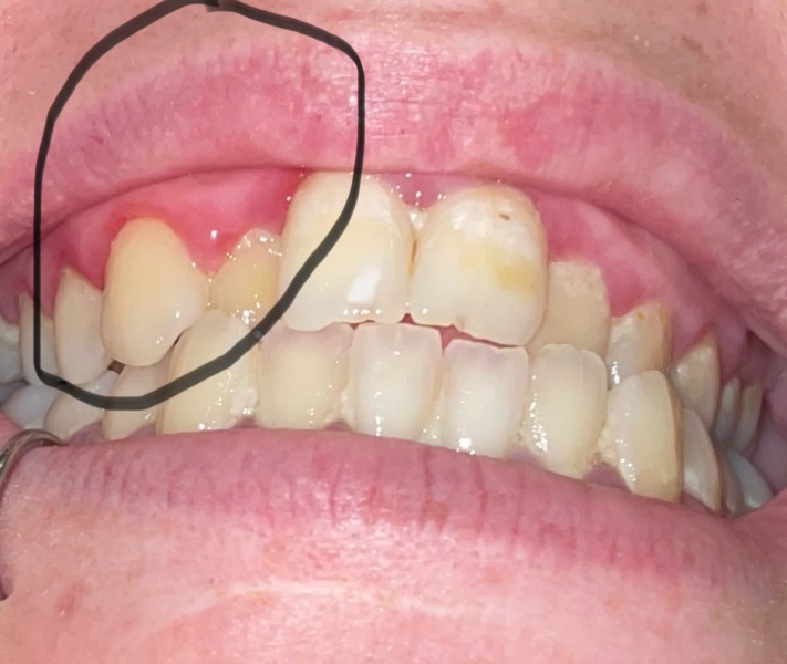 Tooth pain help