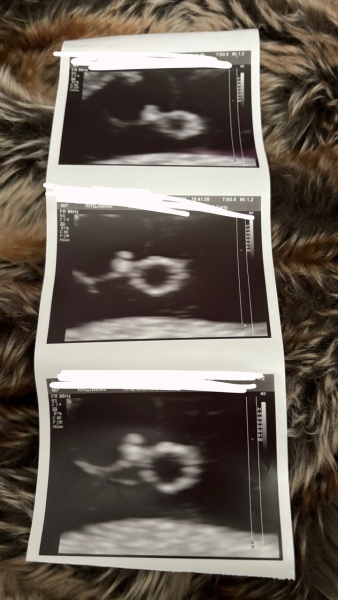 How far would you say this scan is?