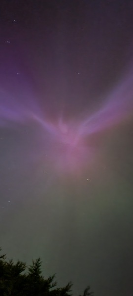 TTC after Early Miscarriage part 3