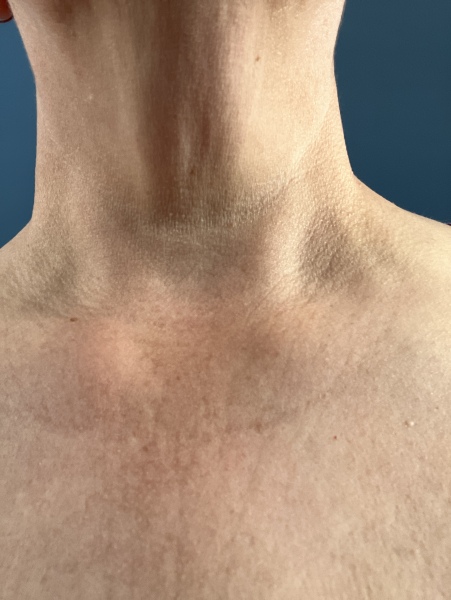 How old is my neck??