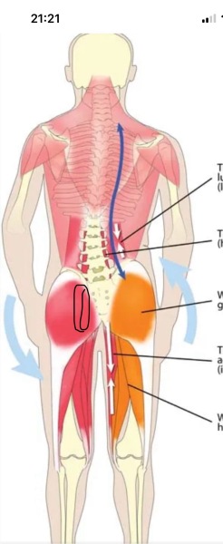 Lower back/bottom pain in DC(9)