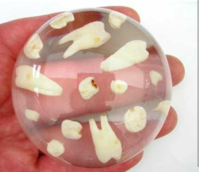 what would you do with these teeth?
