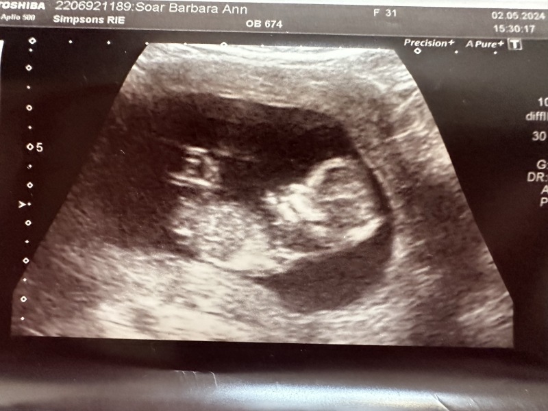 Scan pic gender predictions