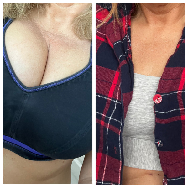 To think big breast & regular running isn’t compatible?