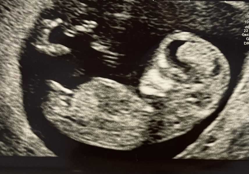Girl or boy?