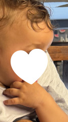 Large forehead/frontal bossing?