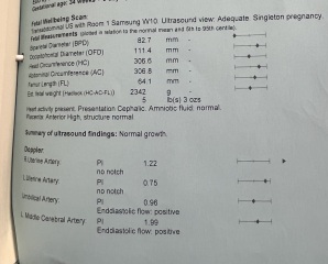 Reduced movement and baby’s weight gain slowed down 36 weeks.
