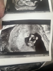 Can anyone guess the gender 💙💕