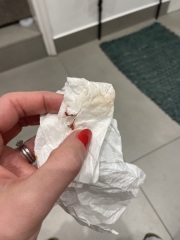 9 weeks pregnant (IVF) - could this be miscarriage? TW blood pics