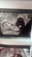 Can you guess my baby’s gender?
