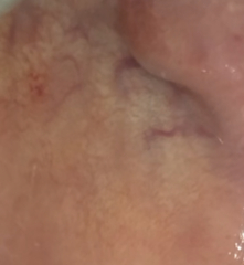 Does my cheek look concerning