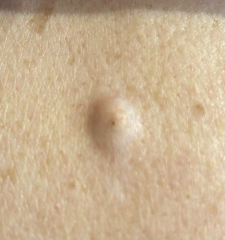 Please help. Just found this on my dad's back.
