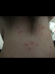 Does this look like shingles?