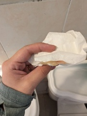 Is this my bloody show? TMI photos