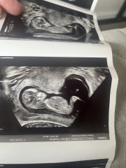 Can anyone guess the gender 💙💕