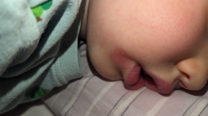 Whats up with my babies face :(