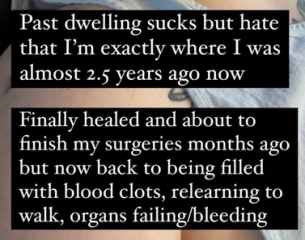 Testosterone gives transmen incontinence, bladder & bowel problems