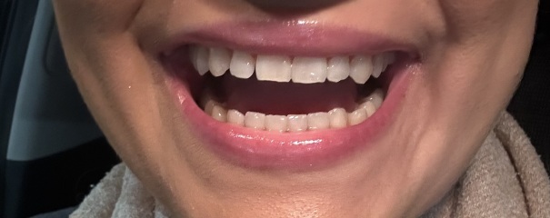 What type of cosmetic surgery is this?