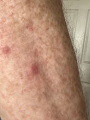 What could these spots be?