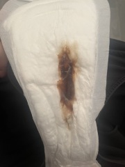 Mucus Plug - is this it? TMI Photo warning!