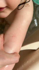 This rash on 3 year old