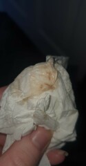 Implantation - no bleed