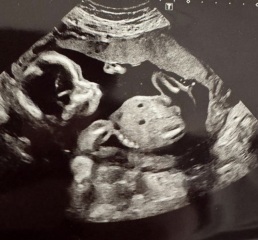 Guess the gender???
