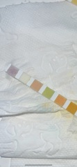 Leukocytes in urine