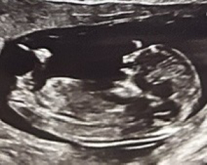 November Babies: Thread 4 (Into the Second Trimester and Beyond!)