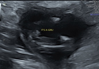 Girl after 2 boys but worried in case it’s wrong?
