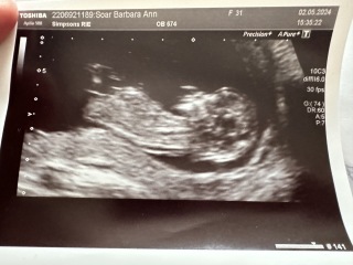 Scan pic gender predictions