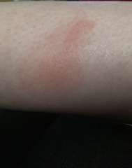 What has eaten me !