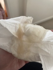 Mucus Plug - is this it? TMI Photo warning!