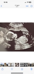 Can anyone advise on gender?