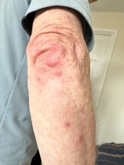 What could these spots be?