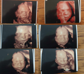 September 2024 - Thread 7! 🐣🧡💛❤️