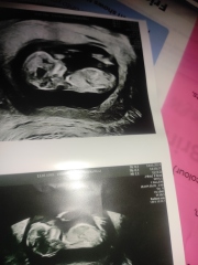 Please could anyone look at my scan for nub theory :)