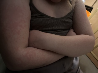 To take DD to the doctor for this rash