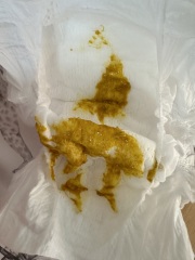 Do these nappies look normal?