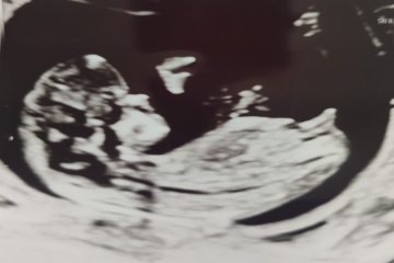 12 weeks and 20 weeks scan... Boy or girl?