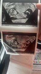 Can you guess my baby’s gender?