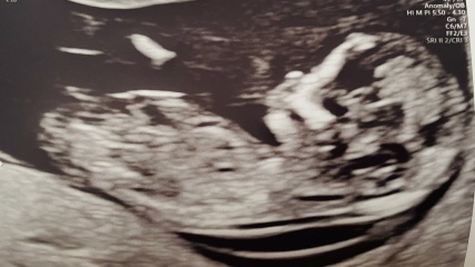 Gender guesses